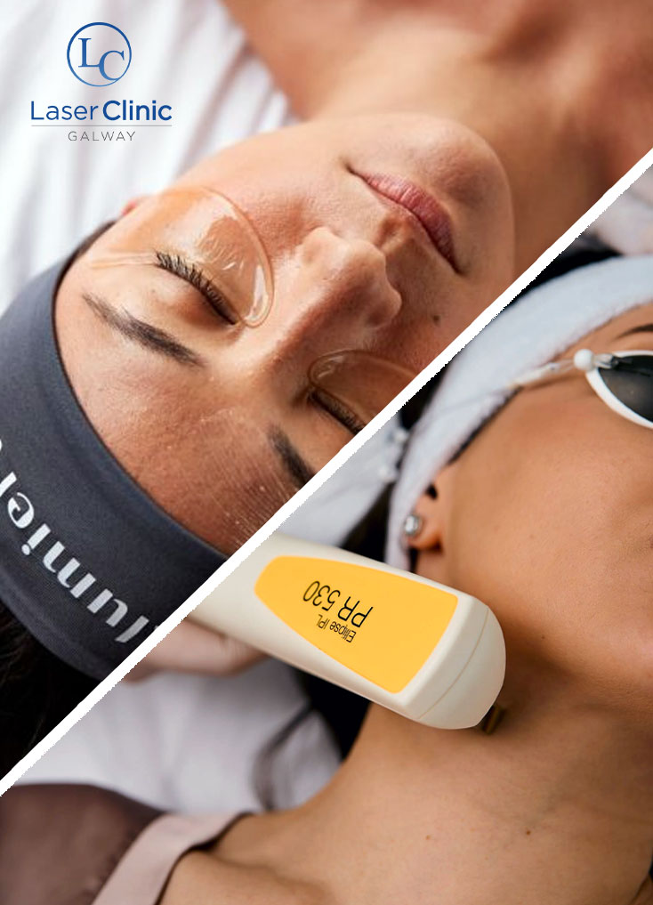 Peel-Pulse-post-image